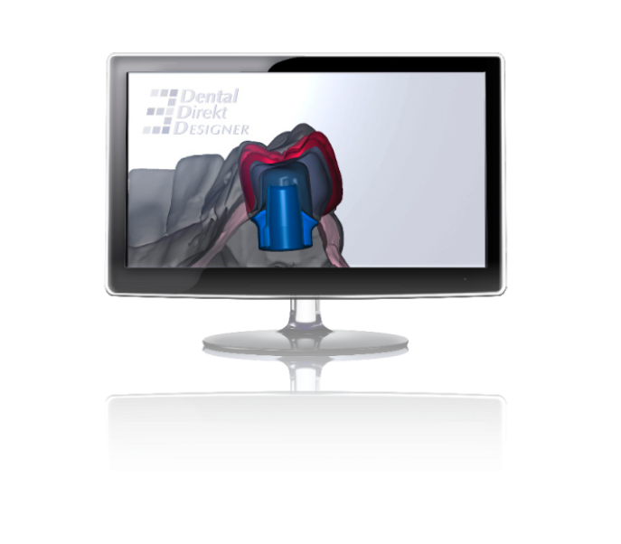 Exocad | Créateur d'Abutments