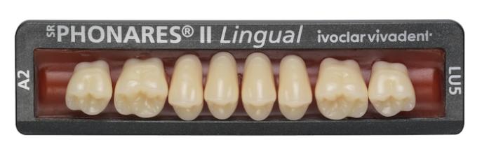SR Phonares II Lingual | Seitenzähnen