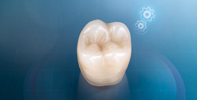 Vita Lingoform Classical | Dents postérieures