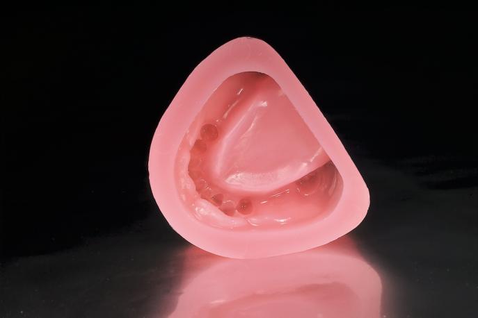 SHERAGEL | Gel pour résine