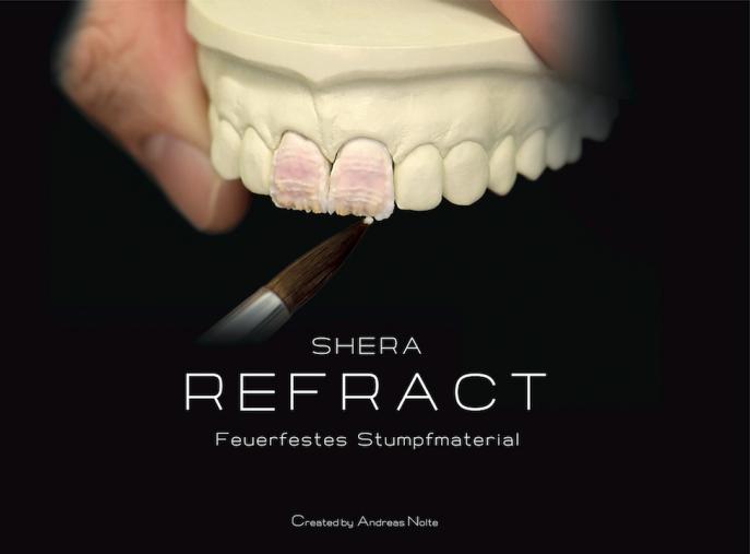 Sherarefract | Keramik Einbettmasse