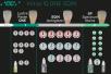 GC ONE SQIN | IQ ONE SQIN System Set