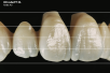 DD CubeY® HL | Hybridlayer
