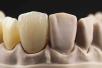 Xip | xDENT341 Beige