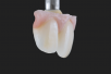 anaxGUM | Gingiva paste
