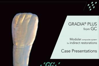 Gradia Plus | Gum