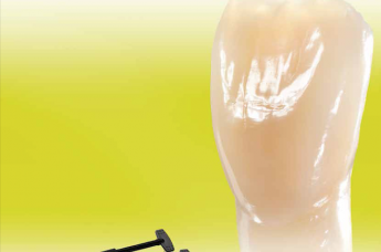 SR NEXCO | PASTE DENTIN